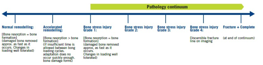 Stress Fracture Continuum